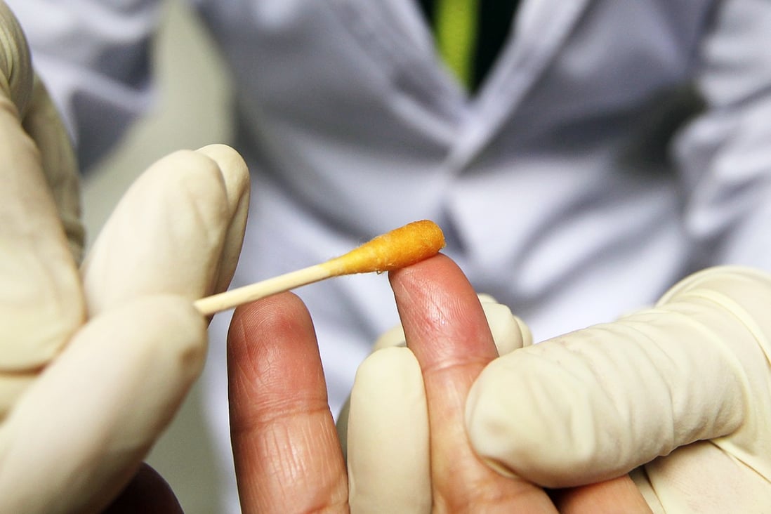 Some 651 people tested positive for HIV in Hong Kong last year. Photo: Simon Song