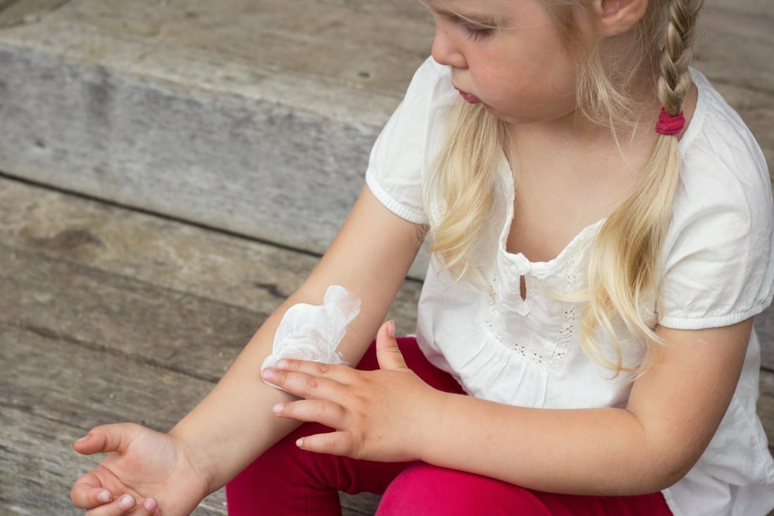 One in five children in developed countries suffer from eczema.