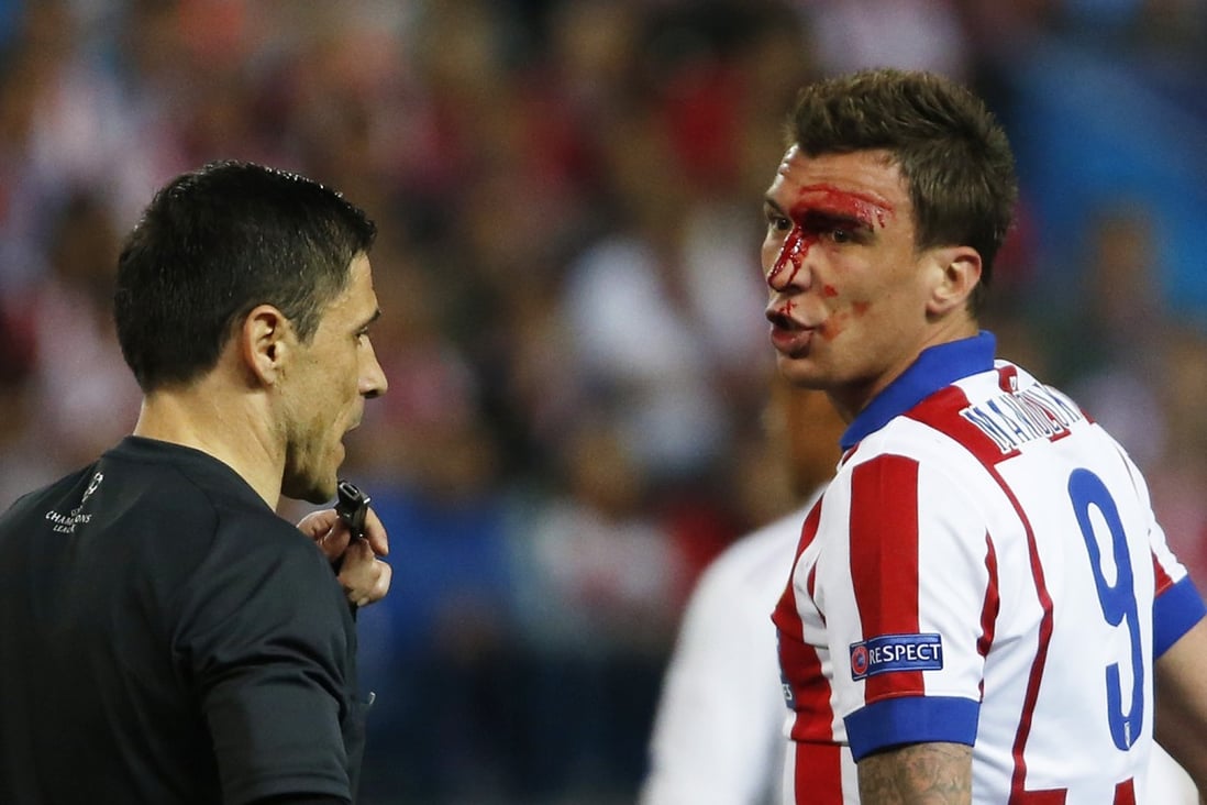 Atletico Players Could Be In Hot Water For Blasting Ref After Draw With Real Madrid South China Morning Post