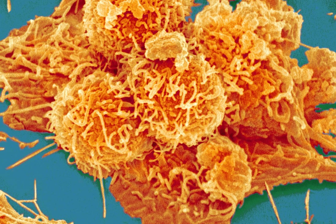 Immunotherapy is being hailed as the new hope to tame cancer at the American Society of Clinical Oncology meeting in Chicago. Photo: Corbis