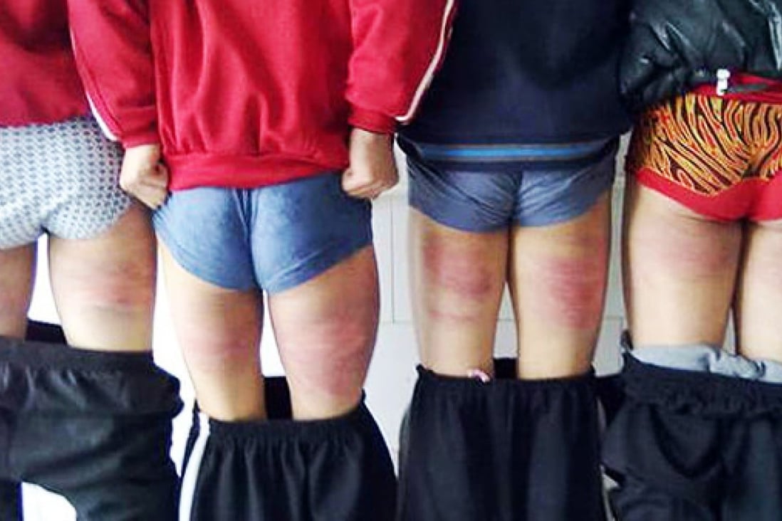 Students at a martial arts school in Henan display welts on the backs of their legs inflicted by their teachers. Violence against children, by parents or teachers, is a growing area of public concern in China. Photo: Weibo