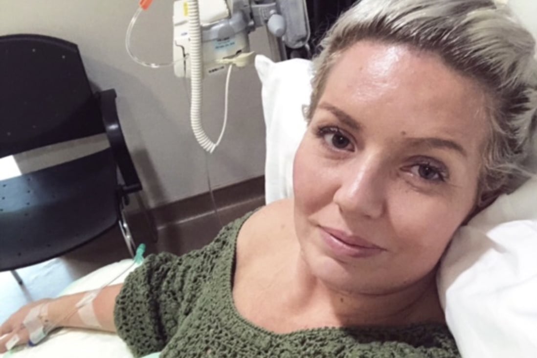 Tanning enthusiast Adele Hughes was diagnosed with Stage 3 skin cancer in 2019. “I don’t want to expose my skin now as I’m covered in scars,” she says. “People don’t understand how dangerous the sun is.” Photo: courtesy of Adele Hughes