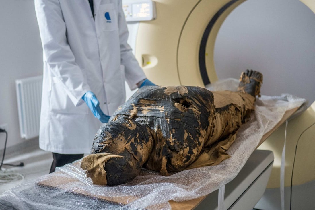 The pregnant Egyptian mummy is prepared for X-ray scans at a medical centre in Otwock near Warsaw, Poland in December 2015. Photo: Warsaw Mummy Project via AFP