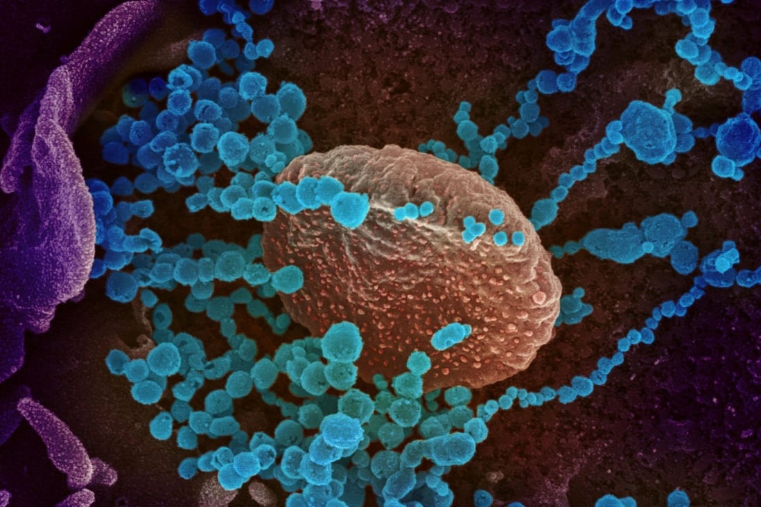 An electron microscope image of the original Covid-19 coronavirus (round blue objects) emerging from the surface of cells cultured in the lab. Photo: NIH via AFP 
