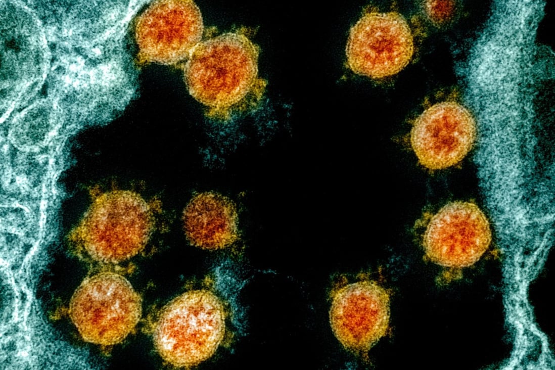 Researchers have called for more effective and coordinated genomic surveillance of Sars-CoV-2 and other emerging viruses to contain this and future pandemics. Photo: EPA-EFE 