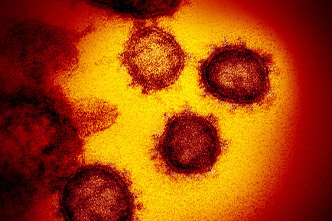 An image from an electron microscope shows SARS-CoV-2, the virus that causes Covid-19. The US has recorded about 800,000 deaths from the disease. File photo: TNS