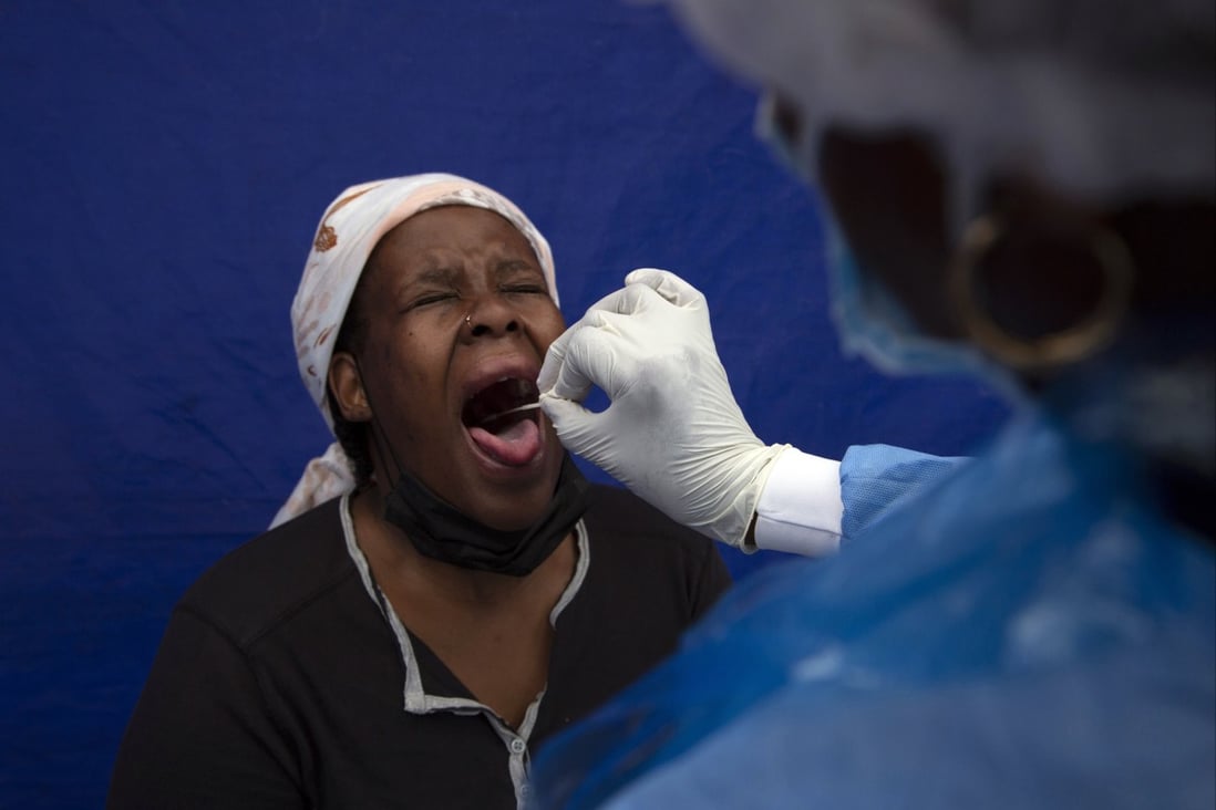 A throat swab is taken from a patient to test for Covid-19 at a facility in Soweto, South Africa. Photo: AP