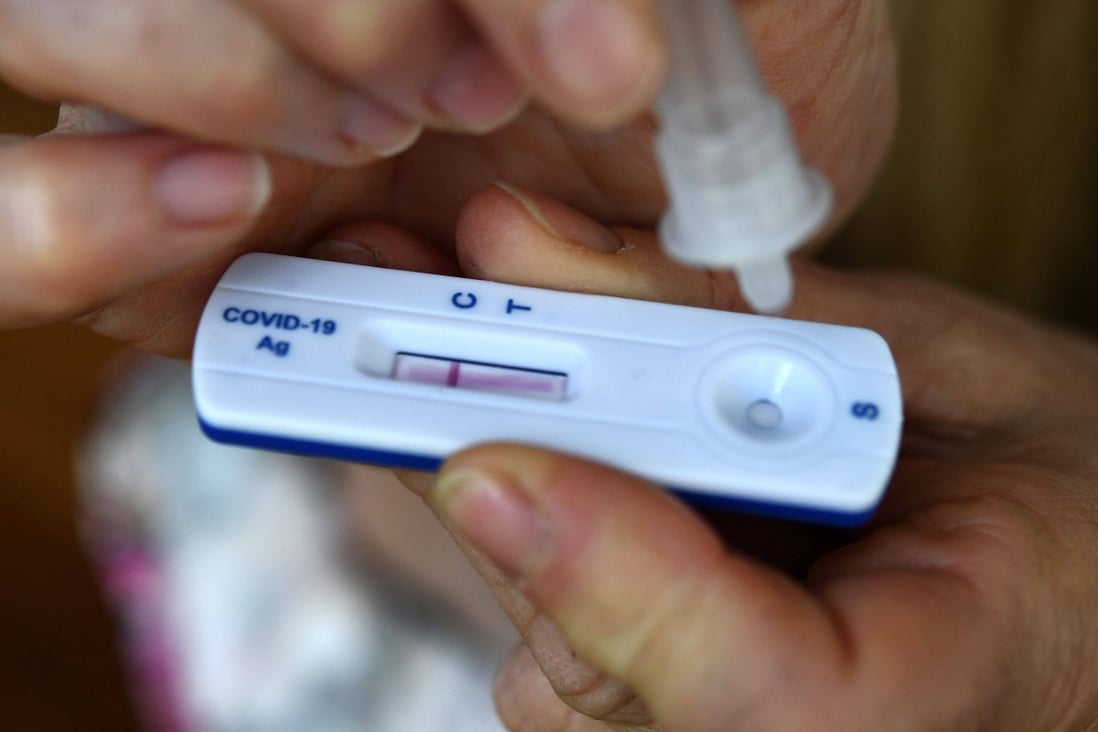 Huge numbers of people around the world have been testing positive for coronavirus. Photo: AFP