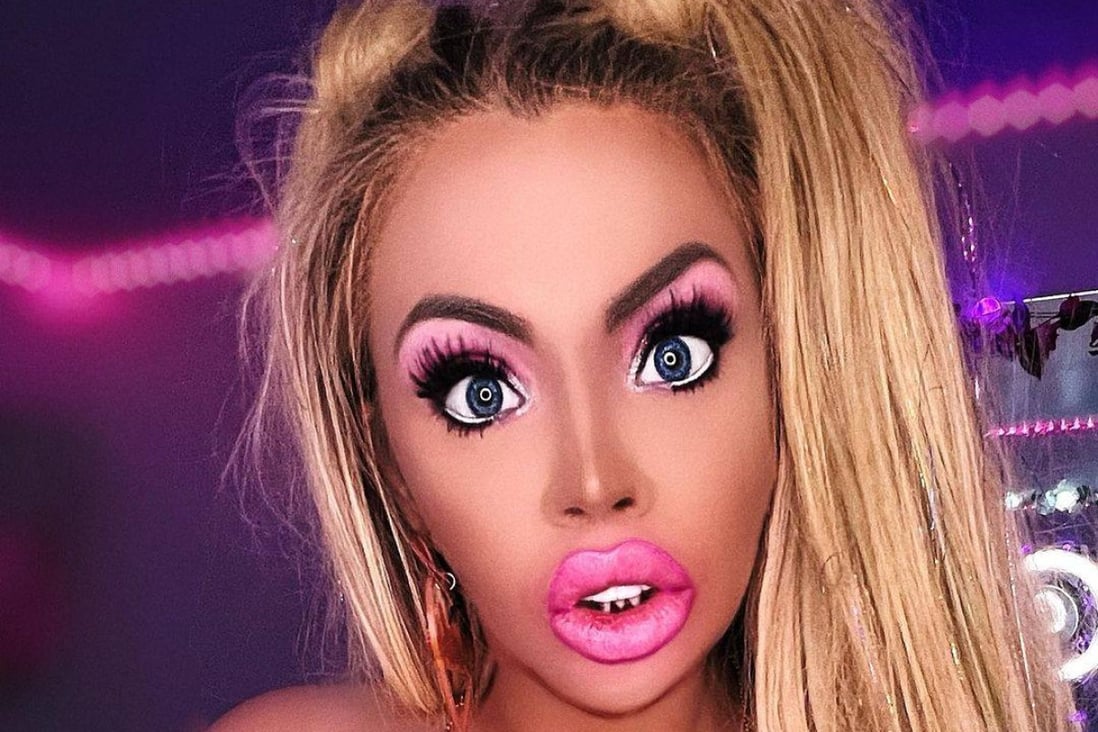 This woman posted on social media about the cosmetic surgery she had had, including lip implants. A Beverly Hills cosmetic surgeon names three procedures people should avoid. Photo: Instagram