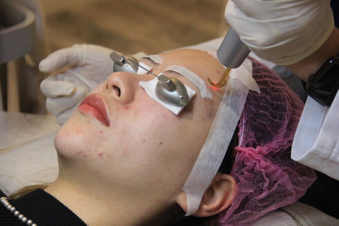 Micro-procedures -- from laser facials and fillers to thread lifts -- are fast becoming the norm in China’s cities where disposable incomes have jumped. Photo: AFP