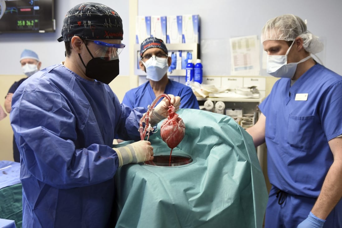Members of the surgical team show the pig heart for transplant into patient David Bennett in Baltimore, Maryland, on Friday. Photo: University of Maryland School of Medicine via AP