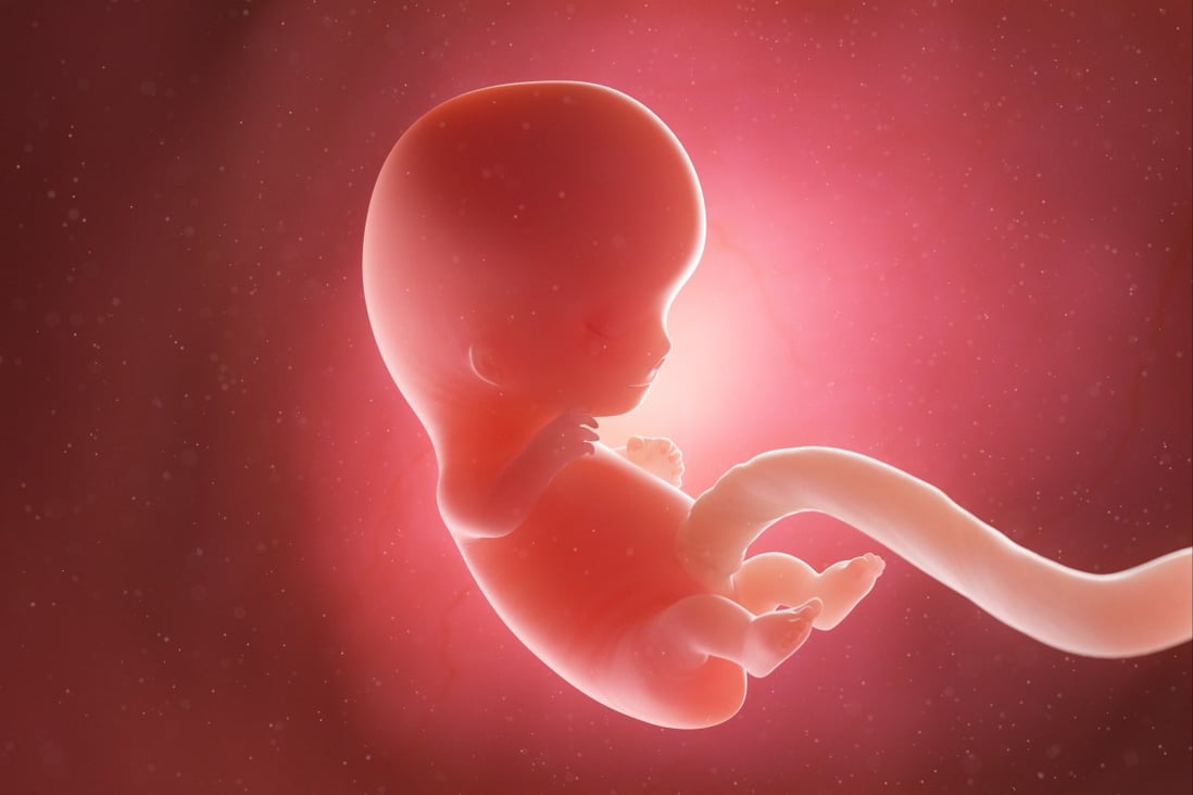 Roboter-Kindermädchen: Chinesische Wissenschaftler bauen künstliche Gebärmutter