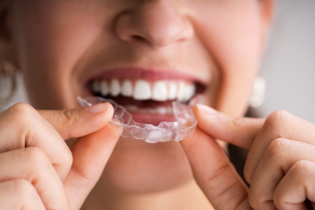 Stress-related dental problems have increased during the pandemic, but mouth guards and meditation may help, say dentists. Photo: Getty Images