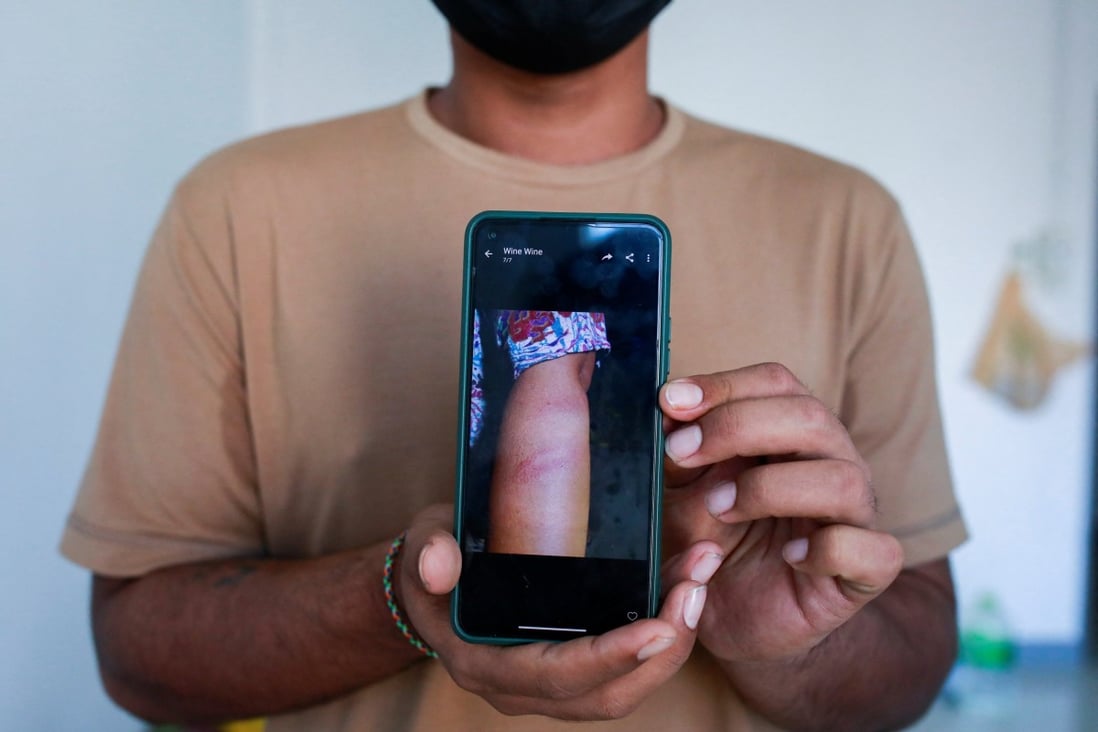 Lin Lin Bo Bo, whose parents cut ties with him, shows a picture of his mother’s wounds that he said were caused by Myanmar military supporters beating her. Photo: Reuters