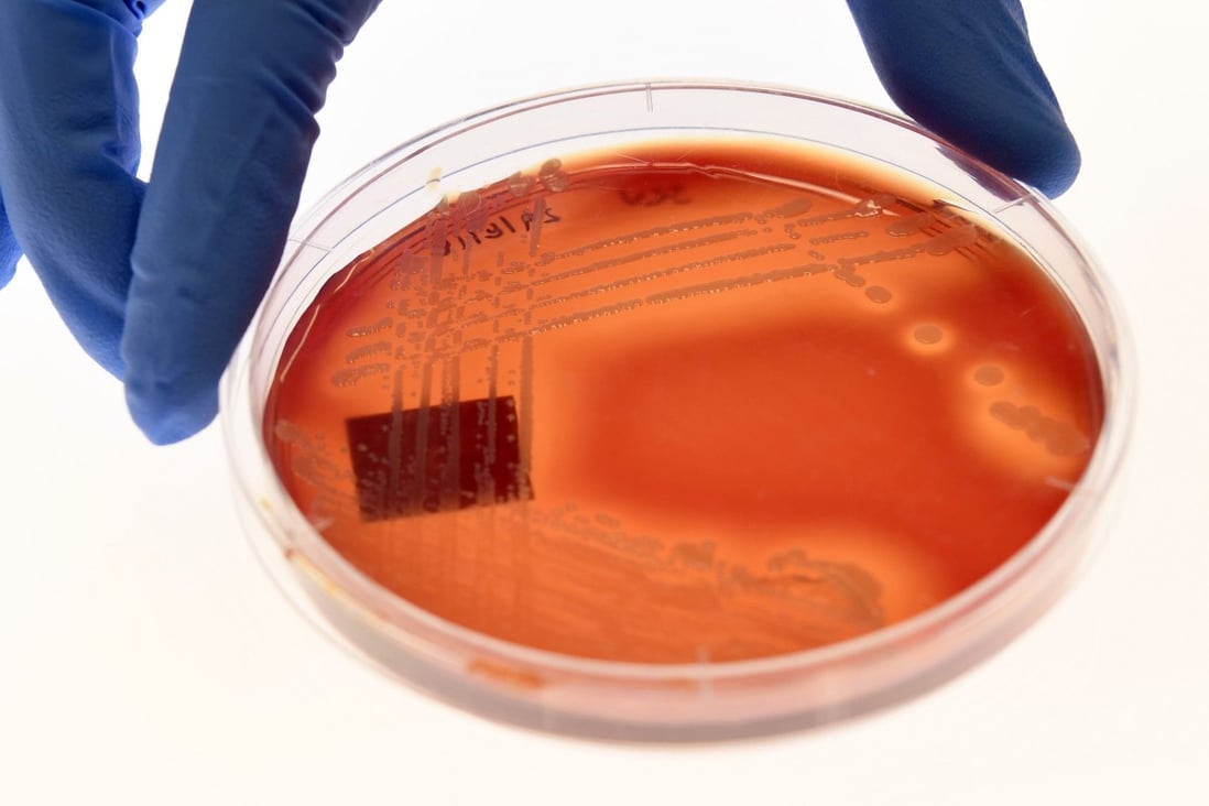 Staphylococcus epidermidis, a bacterium found on human skin, and one of the most common causes of hospital-associated infections, is displayed on an agar plate in Melbourne. As antibiotics are used over and over again, more bacteria are evolving into drug-resistant superbugs. Photo: TNS