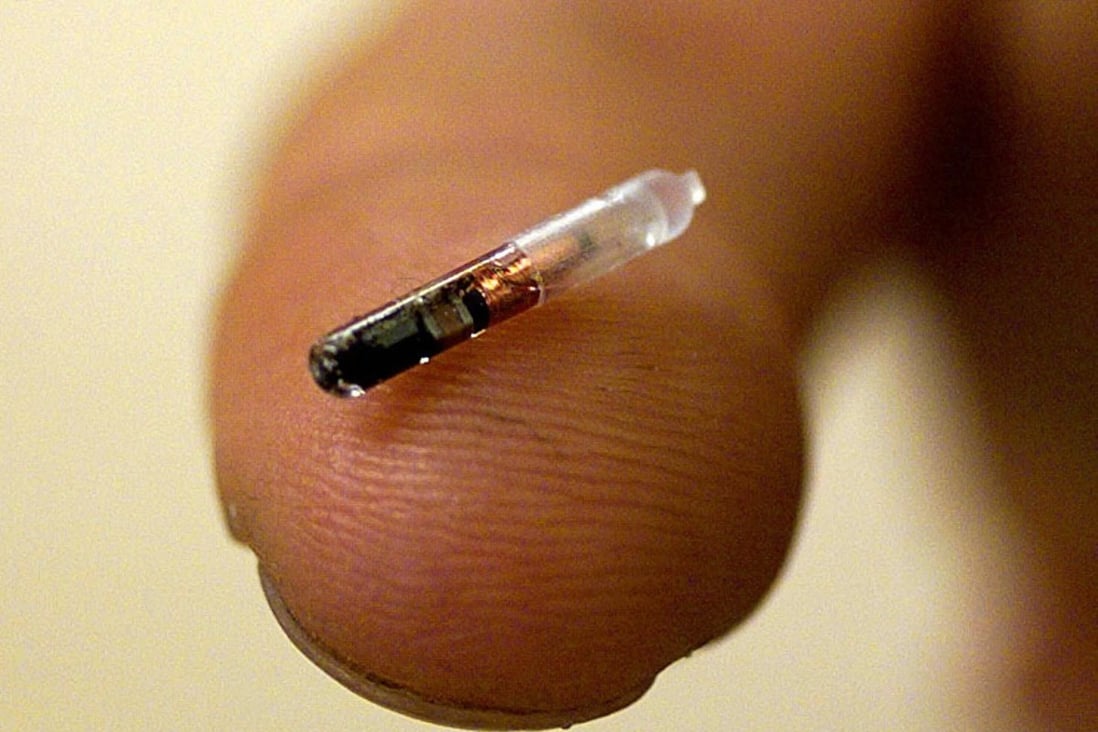 Pet project: Would you get an implanted microchip used for pets to ...