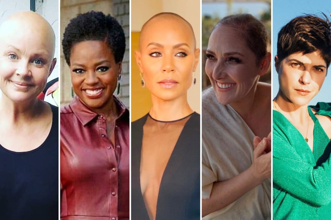 Besides Jada Pinkett Smith, these 10 other celebs have all opened up about having alopecia too. Photos: @gailporter, @violadavis, @jadapinkettsmith, @rickilake, @selmablair/Instagram