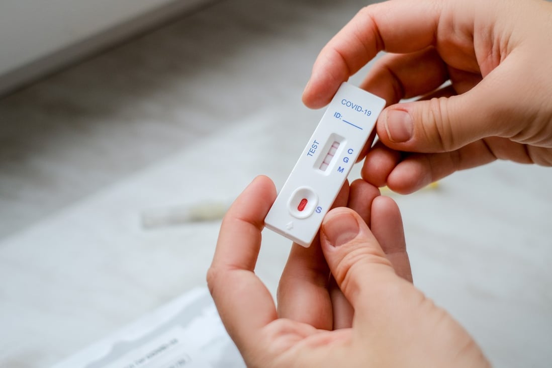 A biotech company has launched a platform to allow patients self-isolating at home in Hong Kong to check their Covid-19 viral load through photos of rapid test kits. Photo: Shutterstock Images