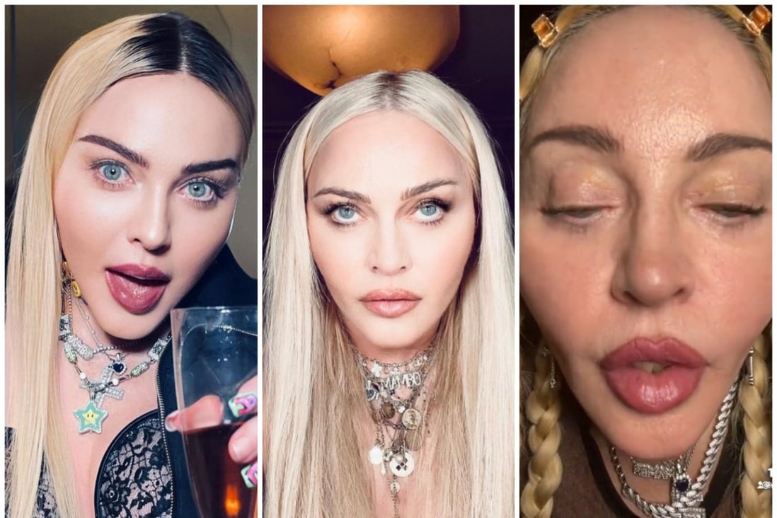 Seedling Contract Automatically Filters or fillers? Madonna's shock new look and transformation over the  years – the pop queen sparked surgery rumours again after her  unrecognisable Grammys TikTok | South China Morning Post
