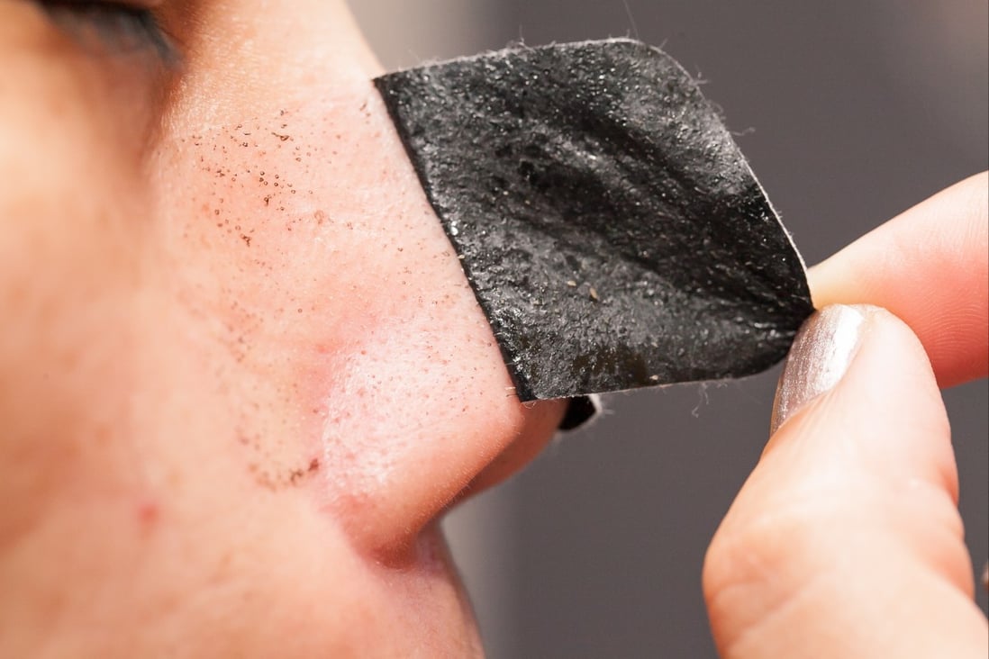 Why blackheads and to get rid of them – and avoid them in the place | South China Morning Post