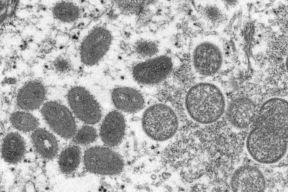 An electron microscopic (EM) image shows mature, oval-shaped monkeypox virus particles as well as crescents and spherical particles of immature virions. Image: CDC via Reuters