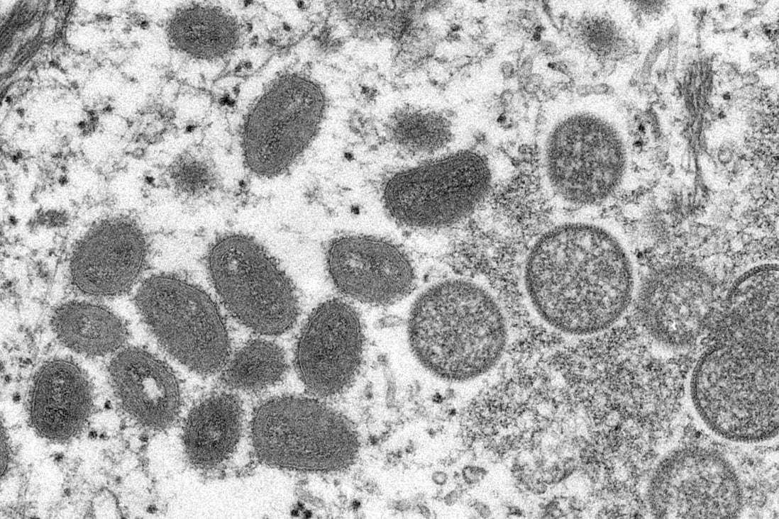 An electron microscopic image shows mature, oval-shaped monkeypox virus particles. Photo: CDC/Handout via Reuters