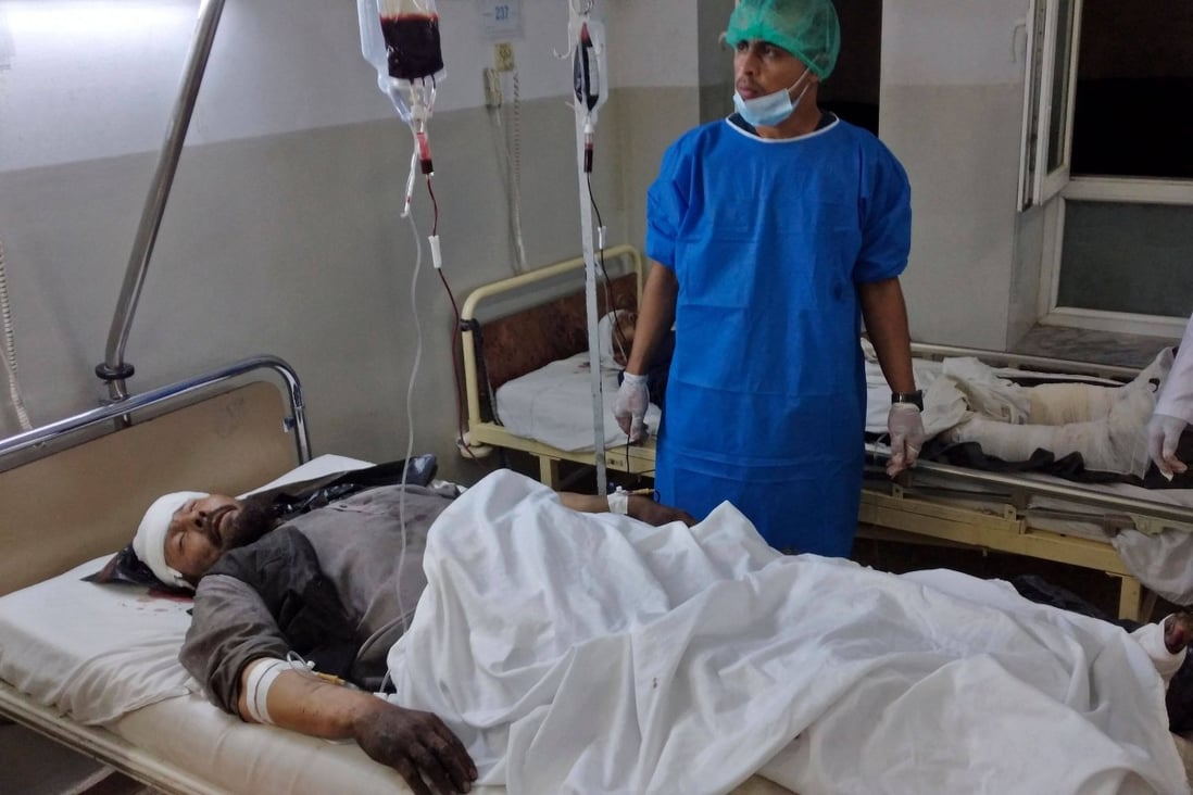 An injured bomb blast victim rests inside a hospital in Mazar-i-Sharif on Wednesday. Photo: AFP