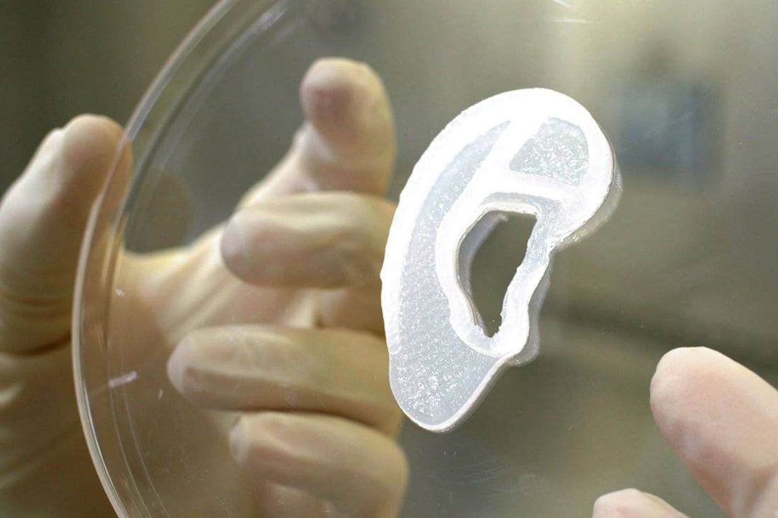 A 3D bioimplant of an ear lobe that was developed by 3DBio Therapeutics. Photo: 3DBio Therapeutics via AFP