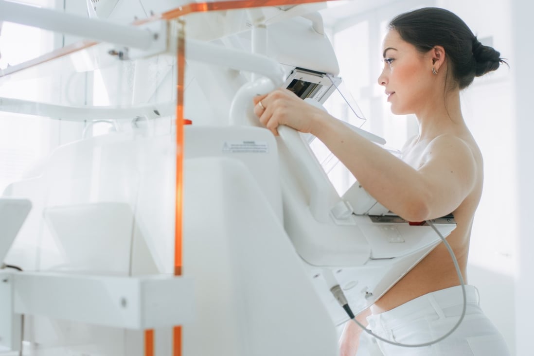 A woman undergoing mammogram screening to detect breast cancer. Photo: Shutterstock