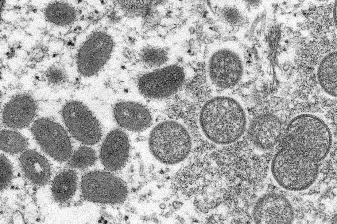 China’s CDC has issued new guidelines on preventing and treating the monkeypox virus. Photo: AP