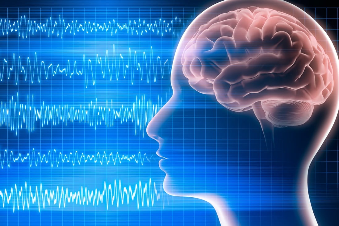 Mind-controlled “metasurfaces” could be used in health monitoring, 5G/6G communications and smart sensors, according to Chinese researchers. Photo: Shutterstock
