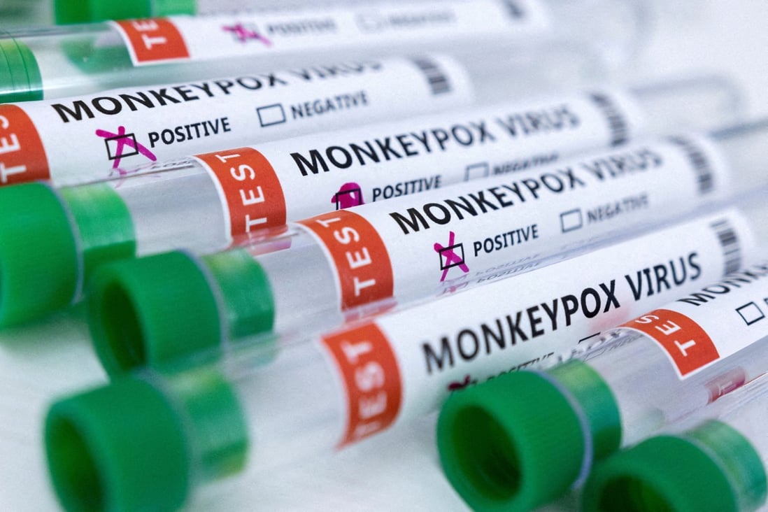 Spain and Brazil reported the countries’ first monkeypox-related deaths on Friday. Photo: Reuters