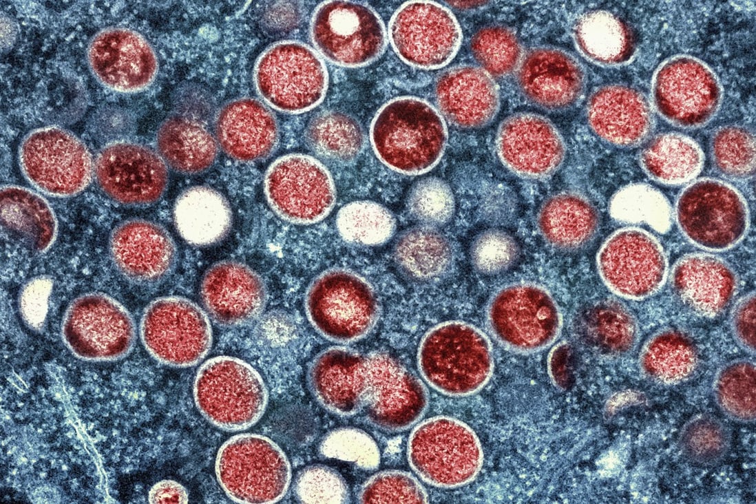 A colourized transmission electron micrograph of monkeypox particles (red) found within an infected cell (blue), cultured in the laboratory. Image: NIAID via AP