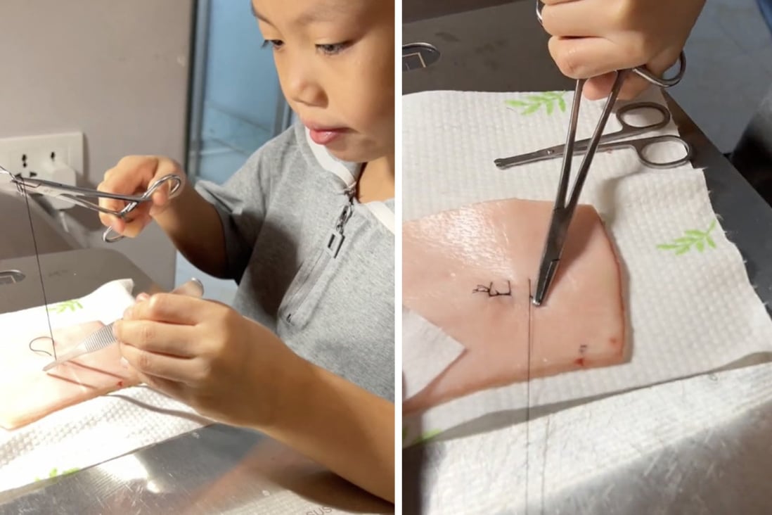 A girl in China, aged 8, stuns social media in a video showing her demonstrating suturing techniques taught by her father who is a doctor. Photo: SCMP composite