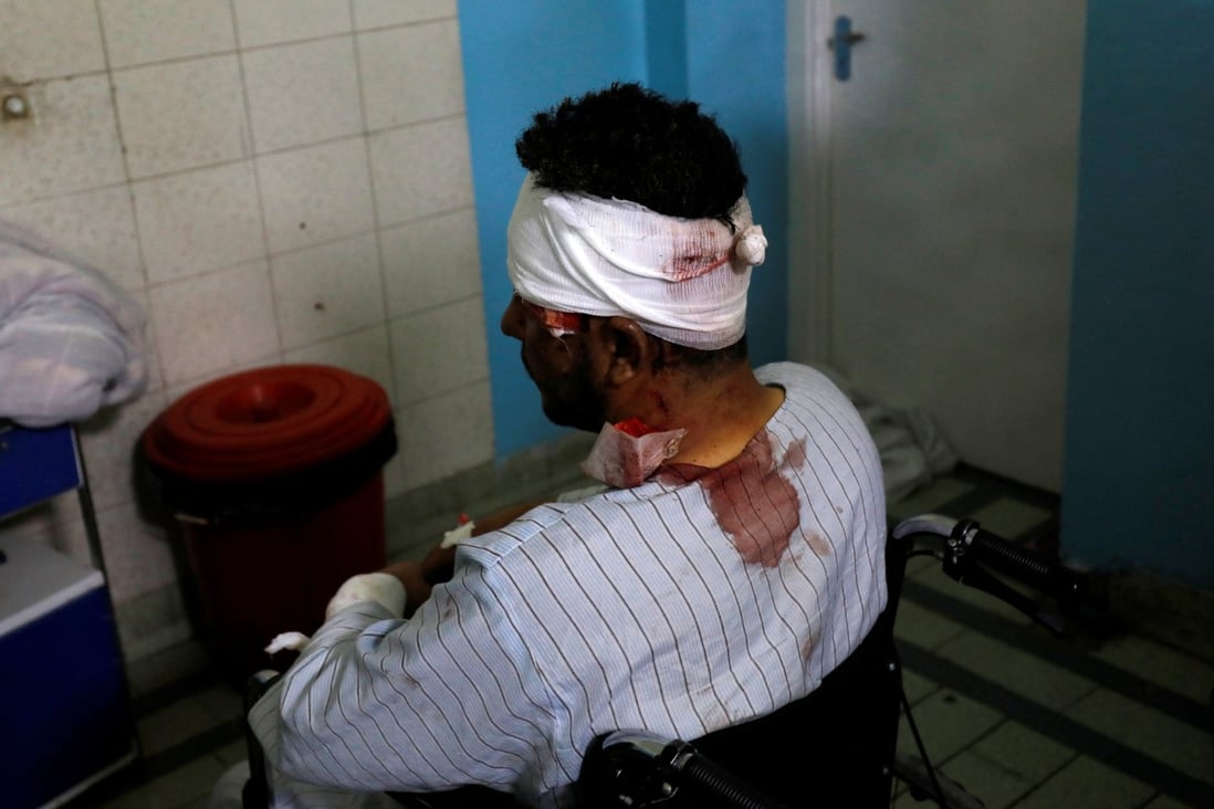 A man wounded after a suicide bomber detonated explosives near the entrance of the Russian embassy in Kabul waits for treatment in a hospital on Monday. Photo: Retuers