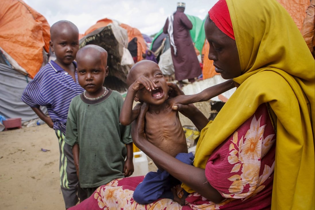 A mother and her malnourished daughter on the outskirts of Mogadishu, Somalia. Photo: AP