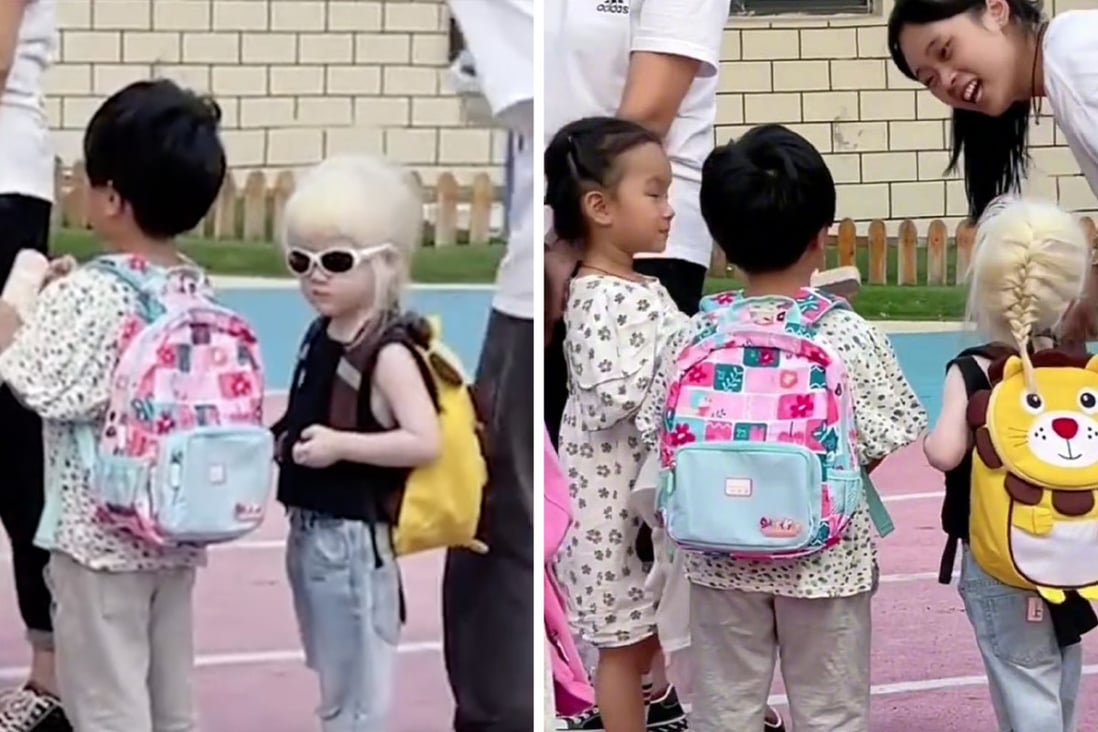 An apprehensive mother in China feared her albino daughter may be marginalised on her first day of kindergarten but was relieved after peers and teachers accepted the girl with open arms. Photo: SCMP composite