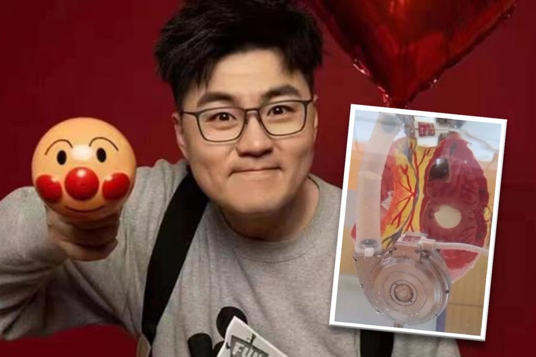 Powered by a rechargeable battery carried on his back, the artificial heart allows Wang to livea normal life. Photo: SCMP composite