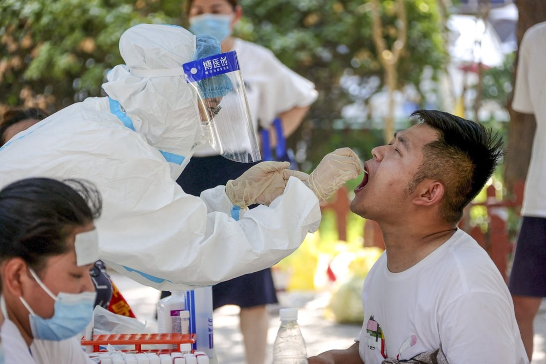 A man receives a nucleic acid test for Covid-19 in Zhengzhou, in China’s central Henan province, on July 31, 2021. Photo: AFP