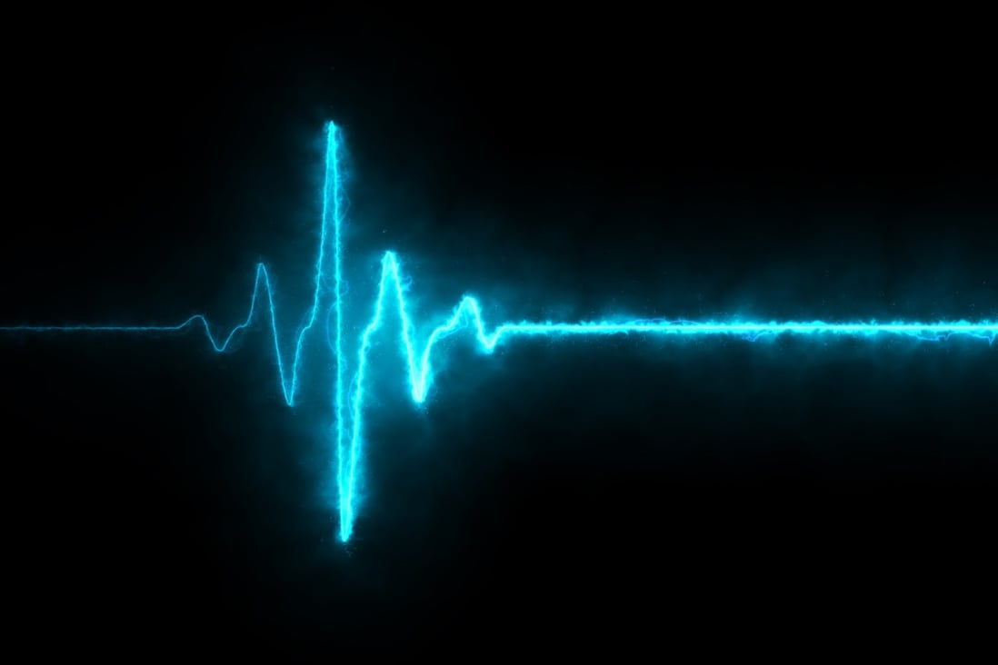 Regular ECG monitoring is known to play a crucial role in diagnosing and preventing heart disease. Photo: Shutterstock