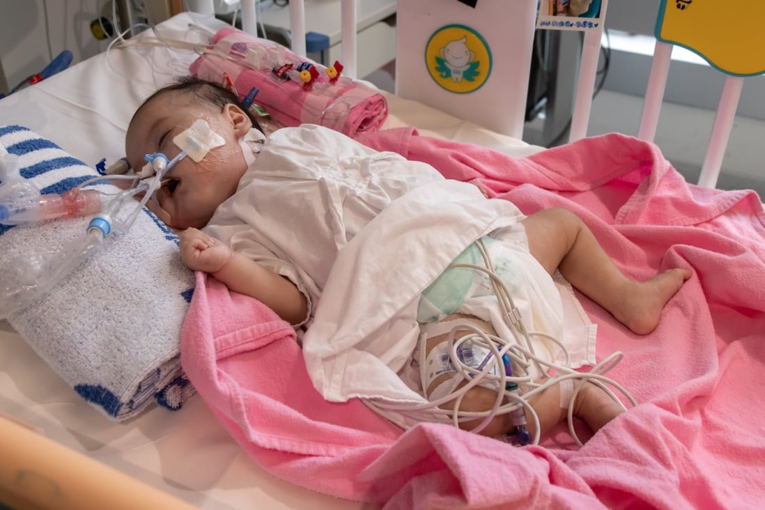 The smallest heart ever transplanted in the city was given to four-month-old Cleo Lai Tsz-hei last Friday after an unprecedented effort to secure the organ from a donor on the mainland. Photo: Hong Kong Children’s Hospital 