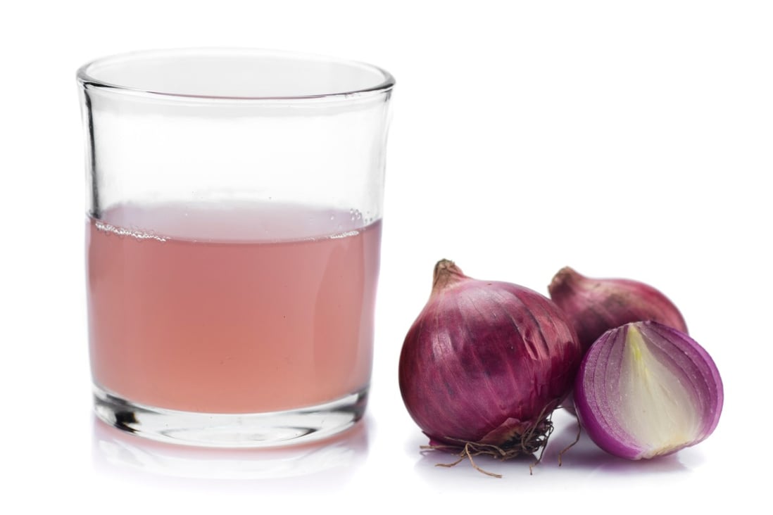 Onion water flu ‘cure’ trending on TikTok gets the thumbs down from experts; see a doctor if you