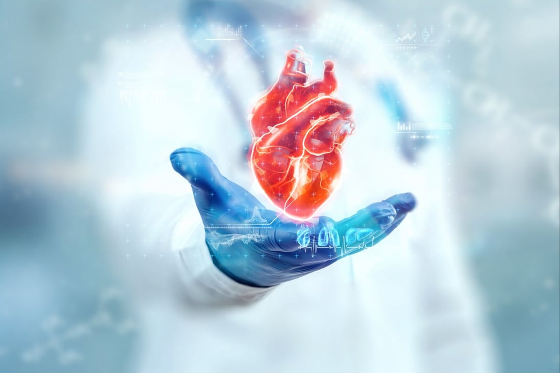 Heart attacks are a leading cause of death worldwide. Photo: Shutterstock  