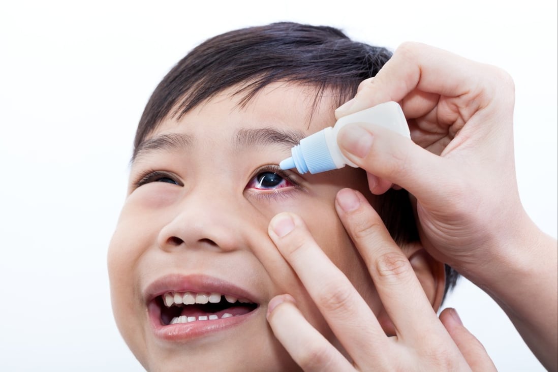 Prescription eye drops may help prevent myopia in children, a study has found. Photo: Shutterstock