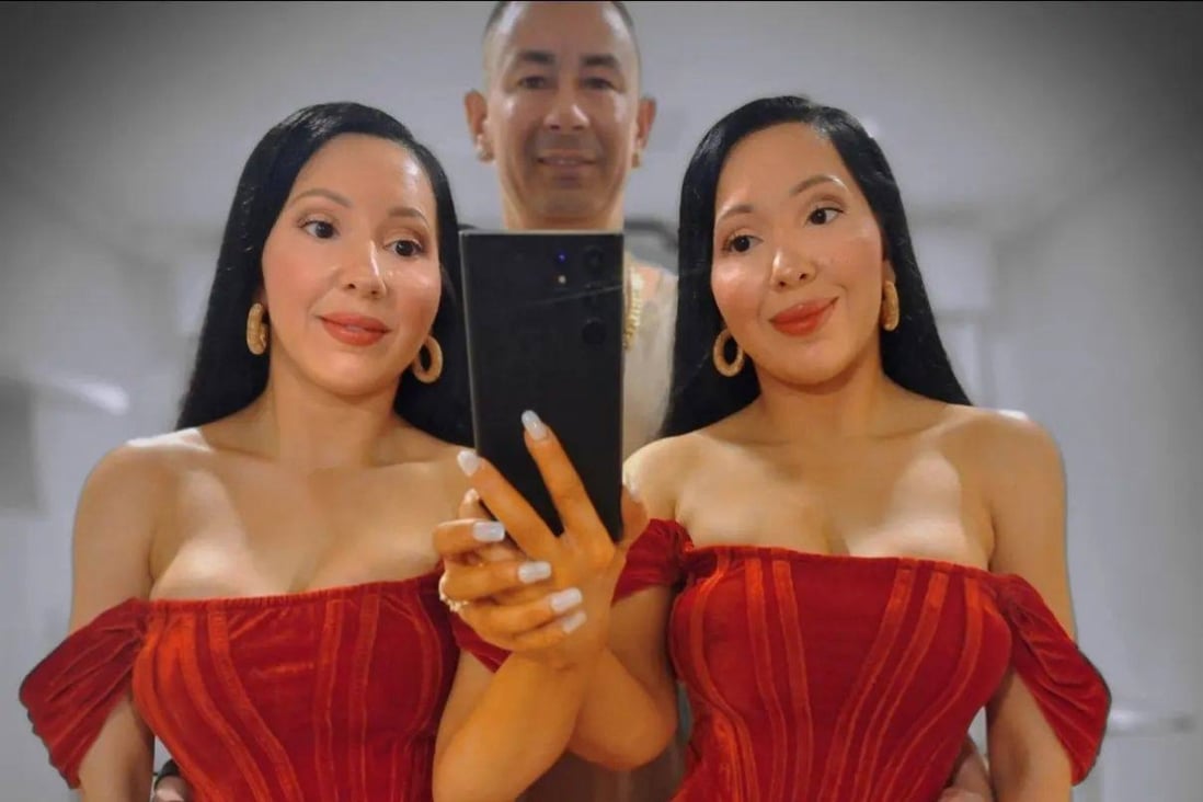 ‘Most identical’ Australian twins share everything – even a fiancé
