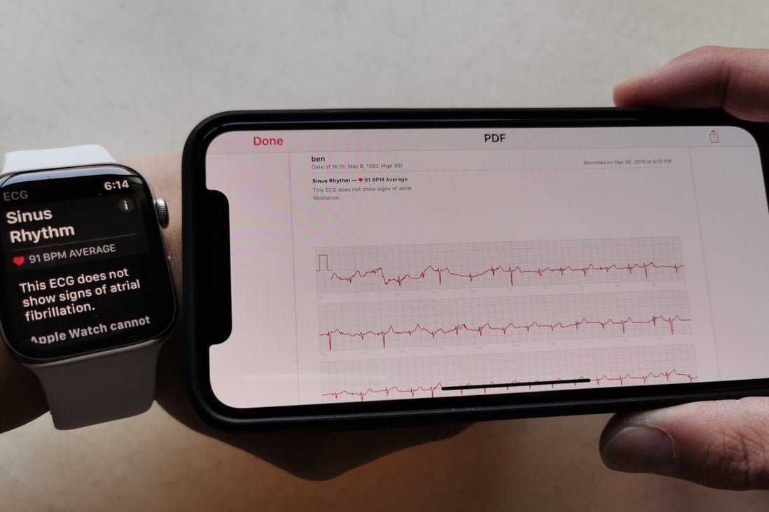 Iwatch ekg release date store