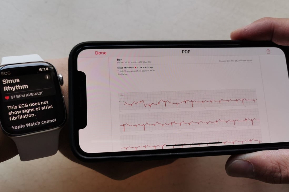 Ben Sin receives the results of the results of the EKG taken via his Apple Watch 4 on his iPhone. Apple launches its EKG app in Hong Kong on Thursday, the first Asian market to have it, and another feature to detect irregular heart rhythms. Photo: Ben Sin