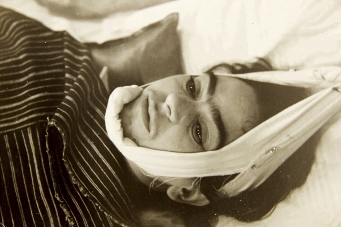 This 1940 photo shows artist Frida Kahlo with her head in bandages. The image is part of a collection of photographs by Nicholas Muray. Photo: Nickolas Muray via Sothebys