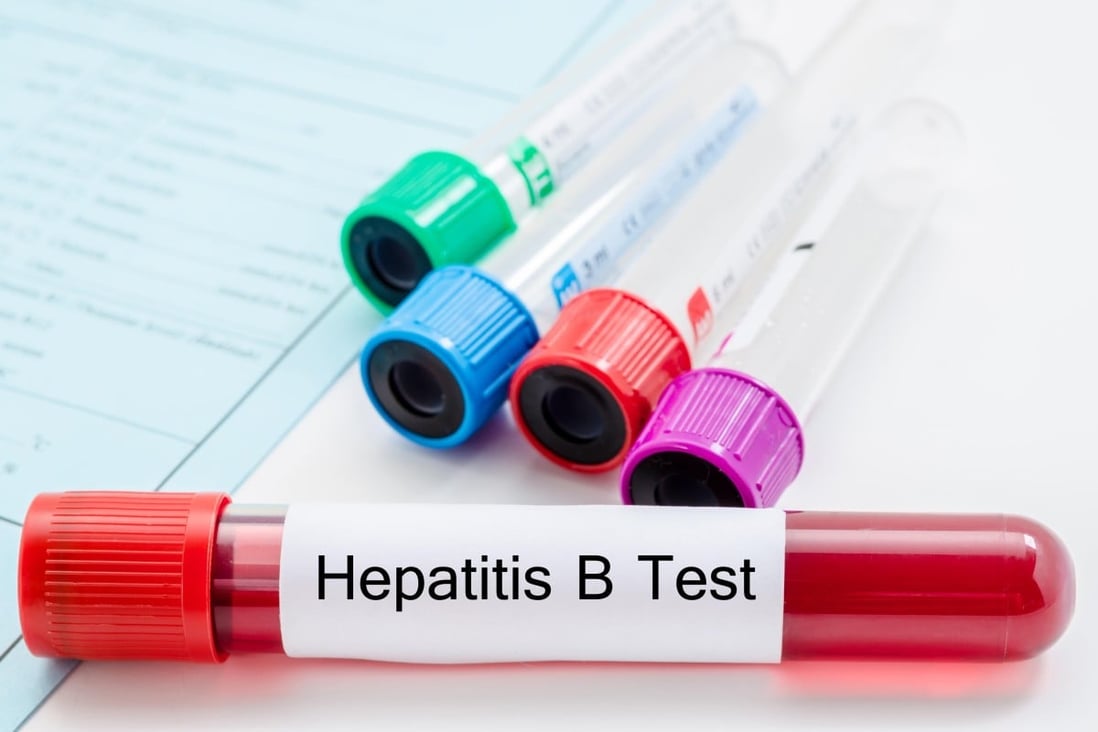hepatitis b cure research