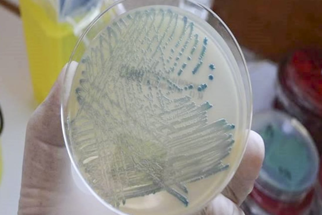 There were 972 cases of carbapenemase-producing enterobacteriaceae (CPE) detected in Hong Kong last year. Photo: Handout
